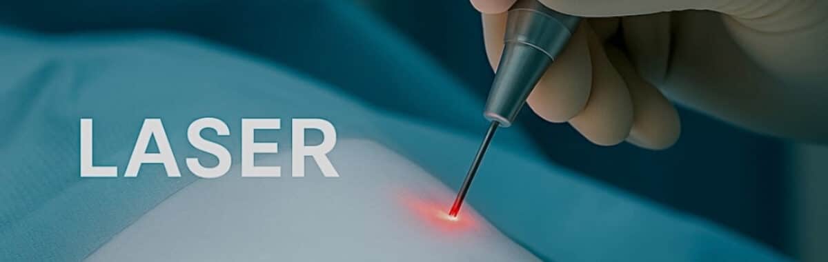 Φίμωση πέους περιτομή με Laser