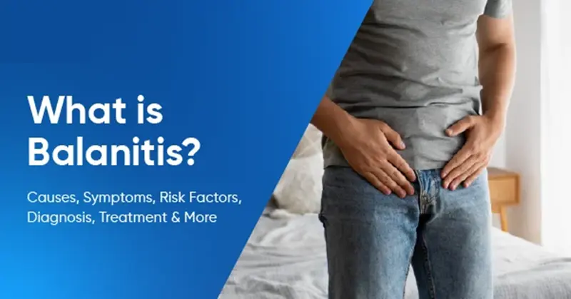 Βαλανίτιδα και βαλανοποσθίτιδα