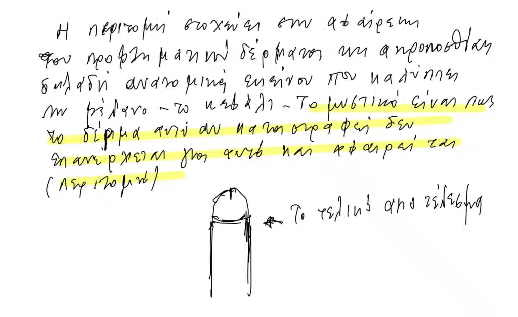 Φωτογραφίες Φίμωσης Περιτομής  – τελικό αποτέλεσμα μετά την αφαίρεση της ακροποσθίας, θεραπεία φίμωσης από Χειρουργό Ουρολόγο Ανδρολόγο Θεσσαλονίκης.